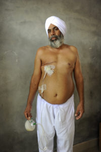 Gurbhej Singh tror plantevernmiddel og kunstgjødsel fremkalte kreftsvulsten han opererte bort for en måned siden.